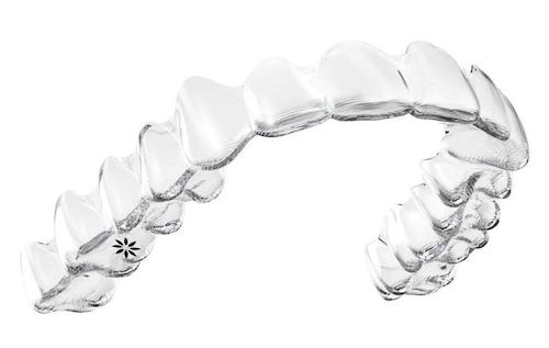 Conoces las fases del tratamiento con ortodoncia Invisalign