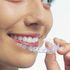 ¿Conoces las fases del tratamiento con ortodoncia Invisalign?