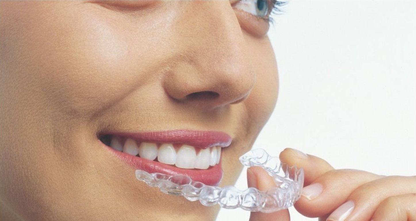 ¿Conoces las fases del tratamiento con ortodoncia Invisalign?