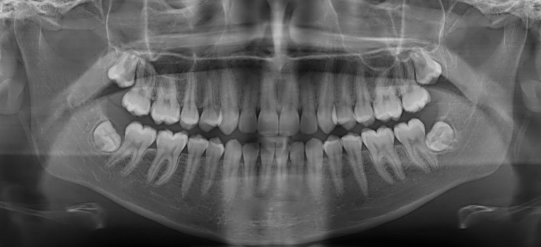 La importancia de un diágnostico dental correcto