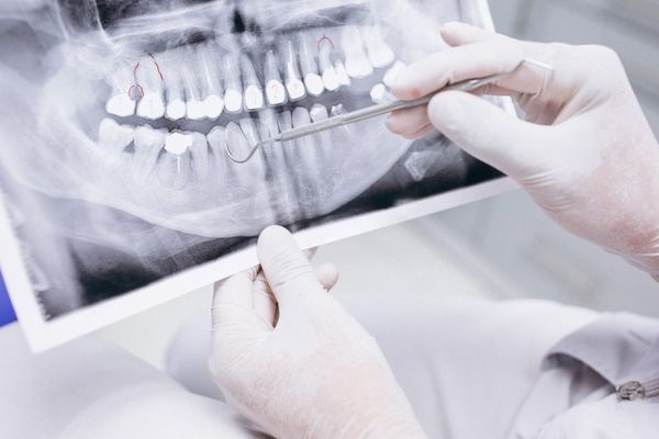 La importancia de un diágnostico dental correcto