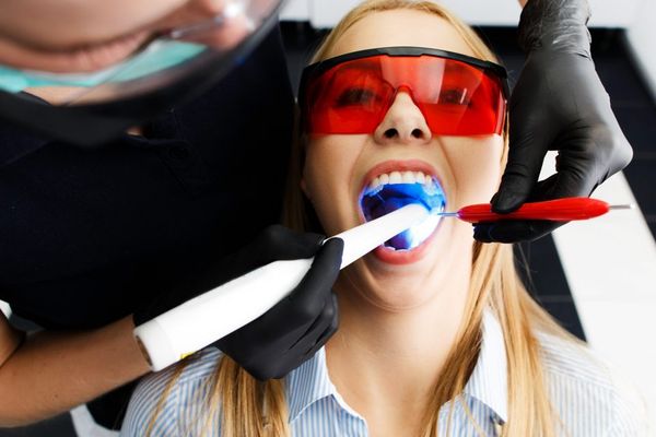 Qué debes tener en cuenta al realizarte un blanqueamiento dental