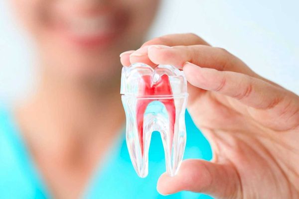 ¿Qué es una endodoncia? Síntomas y tratamiento