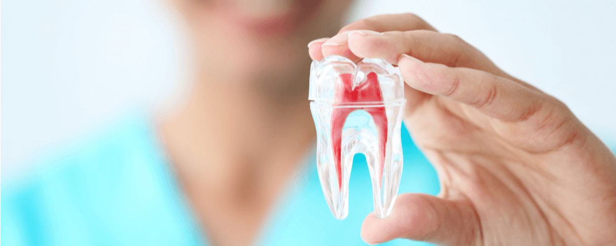 ¿Qué es una endodoncia? Síntomas y tratamiento