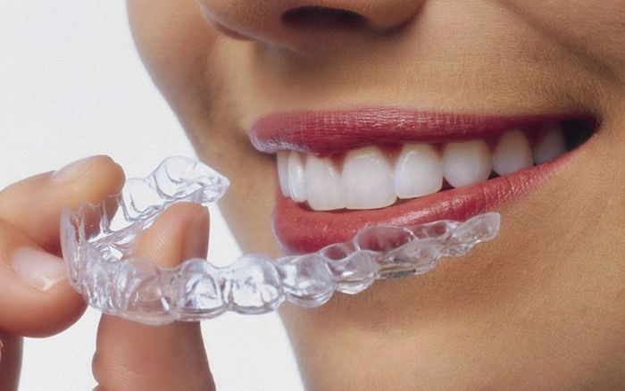 Ortodoncia Invisible Iinvisalign Toledo