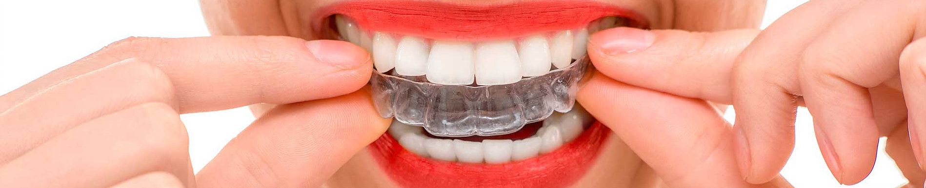 tratamientos dentales clinica dental ventas toledo