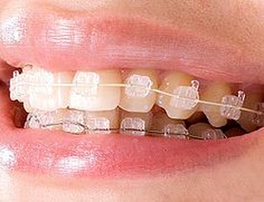 ortodoncia en toledo